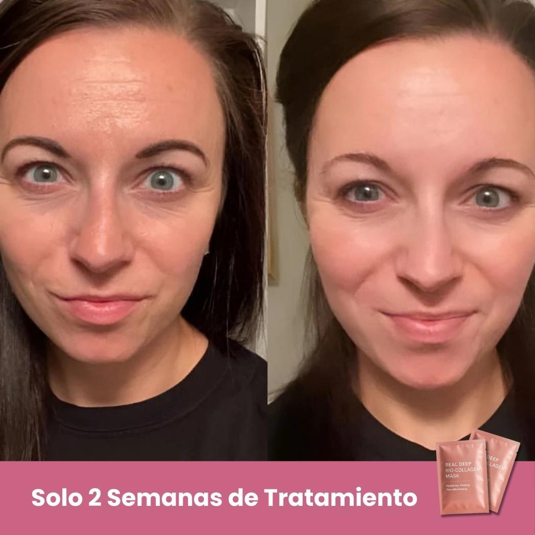 Mascarillas Biocolágeno  Incluye 5 Mascarillas